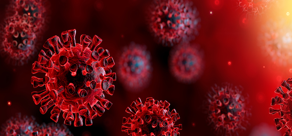 Can Your Business Survive The Covid 19 Virus?